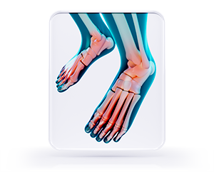 Neuropathy Pain Relieving Therapy